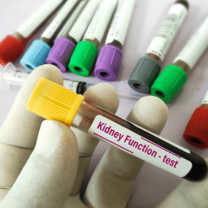 Kidney Function Test