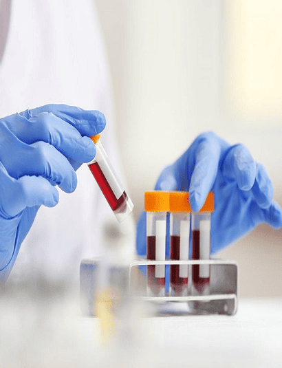Blood test sample