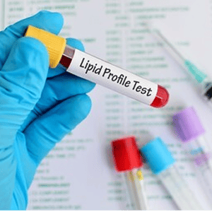 Lipid Profile